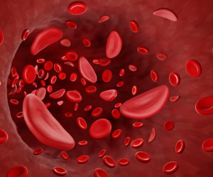 CRISPR Will be Used to Develop Genetic Medicines for Sickle Cell