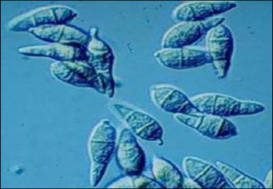 Differential loss of effector genes in three recently expanded pandemic clonal lineages of the rice blast fungus