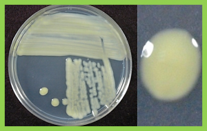 Phylogenomic Insights into Diversity and Evolution of Nonpathogenic Xanthomonas Strains Associated with Citrus.