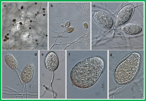 Late blight resistance genes in potato breeding