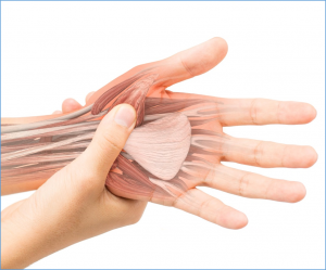 Gene Editing Restores Dystrophin Function in Stem Cells From Patients With Severe Muscle Disorder