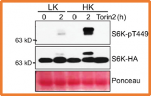 TORC pathway intersects with a calcium sensor kinase network to regulate potassium sensing in Arabidopsis