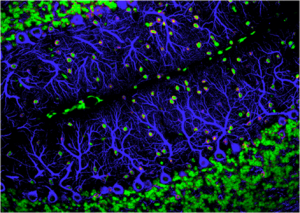 Core Concept: How synaptic pruning shapes neural wiring during development and, possibly, in disease