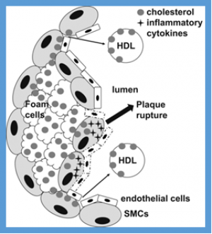 A new pathway of macrophage cholesterol efflux
