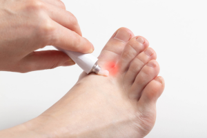 Review of Nanoparticles Usage for Treatment of Fungal Infections