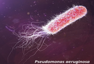 Heat-shock proteases promote survival of Pseudomonas aeruginosa during growth arrest