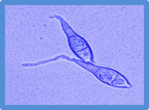 Effects of camptothecin on the rice blast fungus Magnaporthe oryzae.
