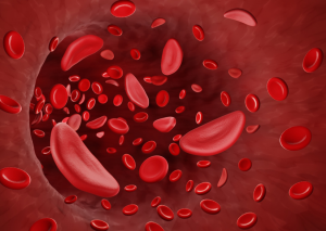 FDA Approves First Gene Therapy using CRISPR-Cas9 to Treat Sickle Cell Disease