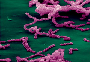 Inner Workings: How bacteria cause pain and what that reveals about the role of the nervous system