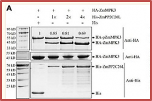 ZmPP2C26 Alternative Splicing Variants Negatively Regulate Drought Tolerance in Maize