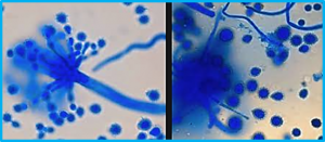 Overexpression of an aquaporin protein from Aspergillus glaucus confers salt tolerance in transgenic soybean