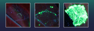 Enhanced CRISPR-Cas9 Enables Stable Insertion of Large Genes