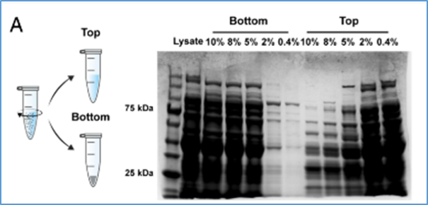 Artificial cells with liquid&ndash;liquid phase separation&ndash;regulated cell-free protein synthesis
