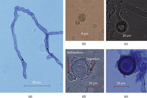 Fine mapping of&nbsp;Ae-Ps4.5,&nbsp;a major locus for resistance to pathotype III of&nbsp;Aphanomyces euteiches&nbsp;in pea